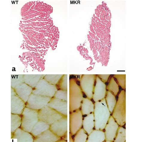 Cross Sections Of Soleus Muscle From 8 Week Old WT And MKR Mice A