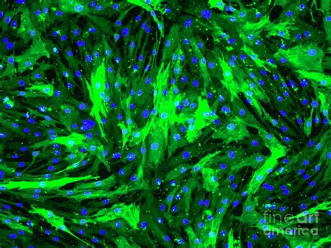 Aortic Smooth Muscle Cells By Daniel Schroen Cell Applications Inc