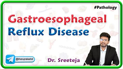 4 Gastroesophageal Reflux Disease Gerd Usmle Step 1 Pathology Youtube