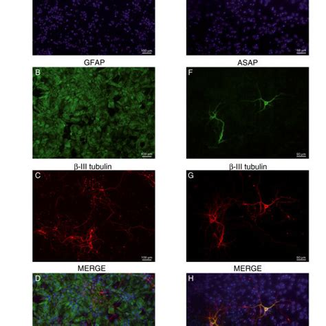 Asap Expression In Testis Immunohistochemical Staining Of Testis