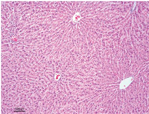 Ccl 4 Treated Group Hydropic Degeneration Fine Arrows And