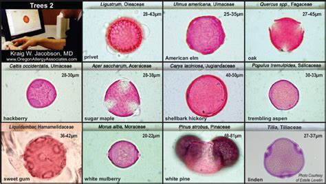 Pollen Counts Oregon Allergy Associates Allergy Care In Eugene Oregon