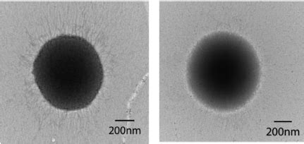Transmission electron microscopic analysis of P. gingivalis fimbriae ...