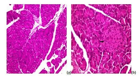 Sections In The Pancreas Of Control Rats Showing The Normal Pancreatic