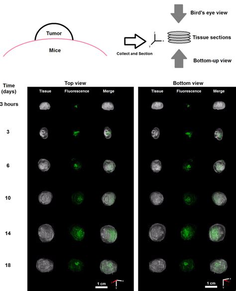 Top And Bottom Views Of Stack Images Of Tumors With Sn Loaded Depots