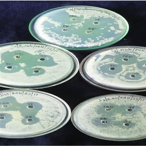 Antibacterial Activity Of Schiff Base Compound I Against