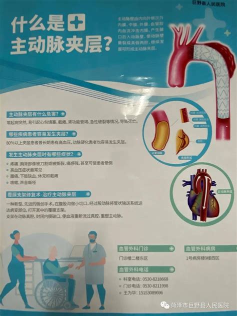 巨野县人民医院血管外科成功为一例主动脉夹层患者实施“castor覆膜支架腔内隔绝术” 巨野县人民医院