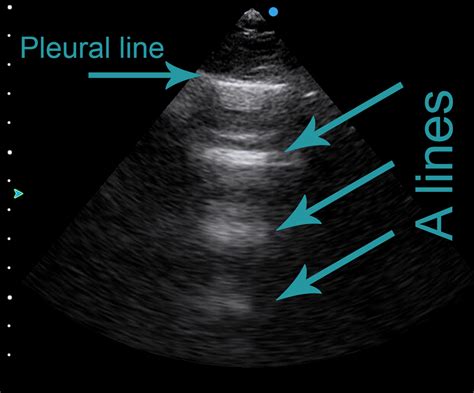 Basic Lung Ultrasound - Members Only - Animal Ultrasound Association