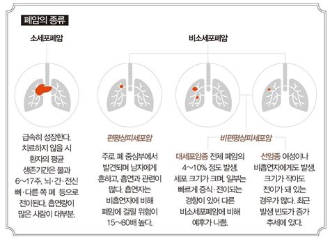 톱 1941 폐암 3기 얼마나 살수 있나요 새로운 업데이트 63 분 전