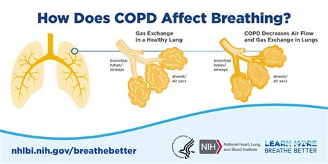 copd affect breathing chronic obstructive pulmon flickr