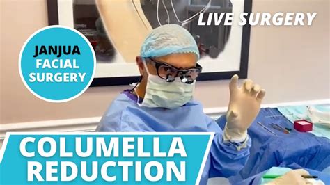 Columella Reduction Nose Job Live Surgery Dr Tanveer Janjua New