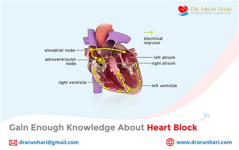 Understanding Heart Block Causes Symptoms And Treatment Options For