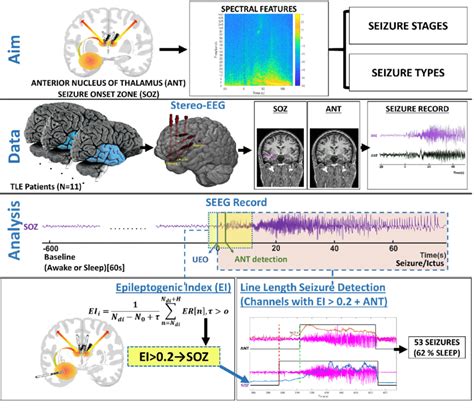 Schematic Overview Of The Study With Eeg Data Processing Pipeline