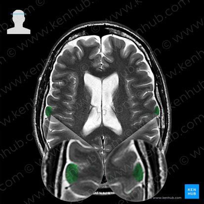 Postcentral gyrus: Location and function | Kenhub