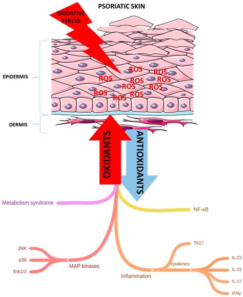 Ijms Free Full Text Oxidative Stress As An Important Contributor To