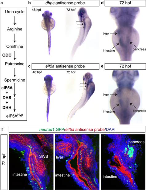 Expression Patterns Of Dhps And Eif A In Zebrafish A Pathway