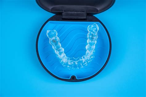 Les Avantages De Lorthodontie Invisalign Clinique St Charles