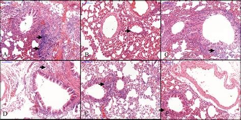 Histological Analysis Of Lung Tissues Representative Image ×150 From Download Scientific