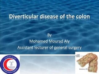 Diverticular Disease Of The Colon Ppt