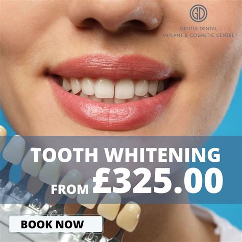 Quickly Brightening Stained Or Discoloured Teeth The Gentle Dental