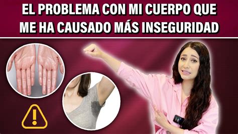 El Problema Con Mi Cuerpo Que Me Ha Causado Más Inseguridad👩🏻‍⚕️l Dra Pau Zúñiga Clips Youtube