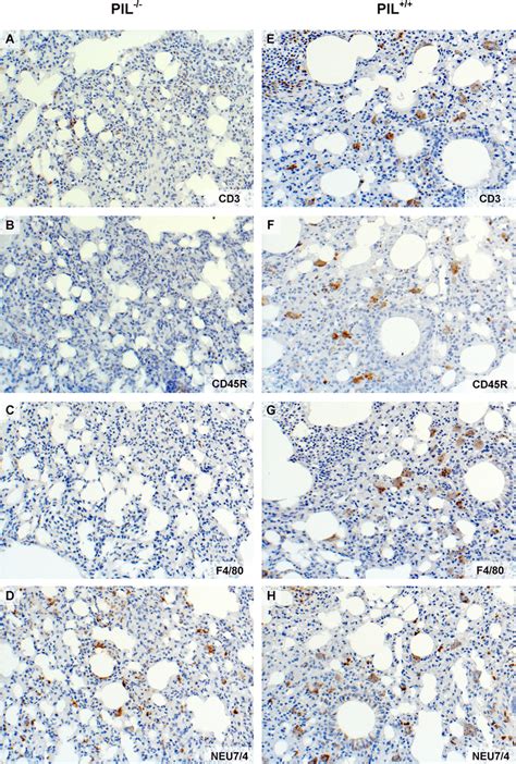 Immunohistochemical Stainings Of Affected Lungs A E The