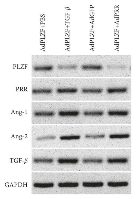 PLZF Inhibits PRR Expression In HK 2 Cells A B Protein And Gene