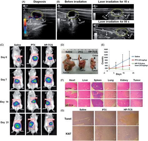 The In Vivo Anti Tumor Activity Studies In Orthotopic Ct26 Luc Tumor