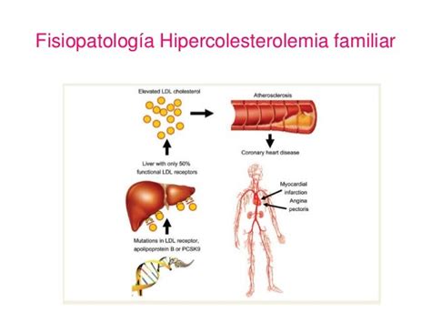 Hipercolesterolemia