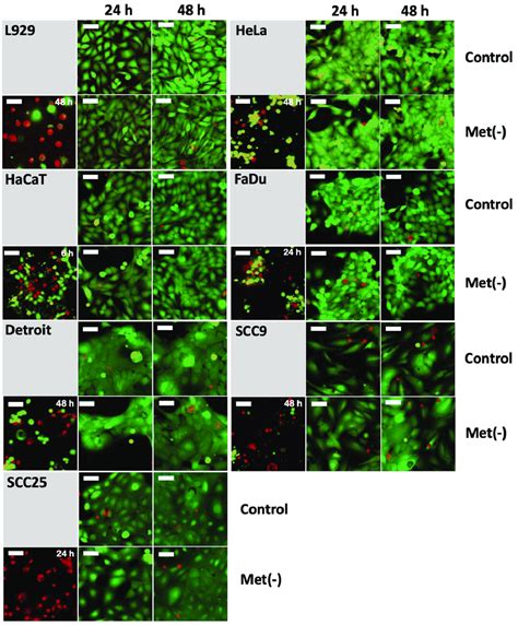 The Cell Lines L929 HeLa HaCaT Detroit562 FaDu SCC9 And SCC25