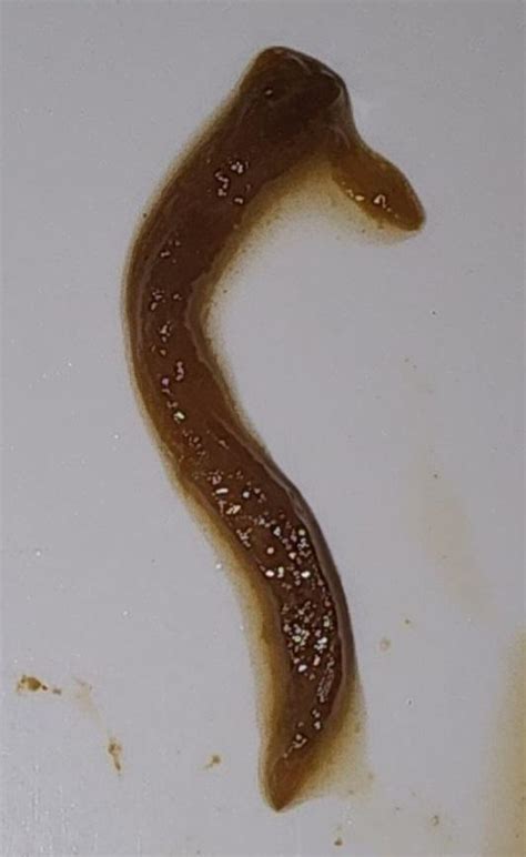 What type of parasite is it?? Help me! : r/parasites