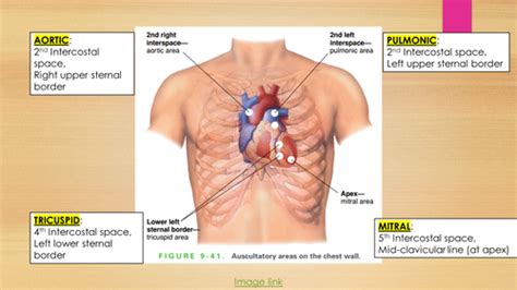 Basic Cv Exam Cardio Flashcards Quizlet