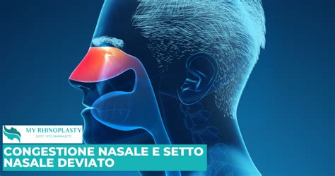 Congestione Nasale E Setto Nasale Deviato 2 Complicazioni Nella