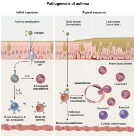 Respiratory Asthma Dropped Image Link Types Of Asthma Cold Induced