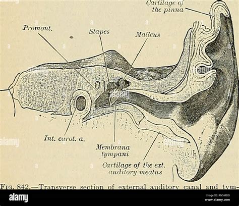 Preauricular Sulcus