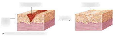 Tissue Repair Diagram Quizlet