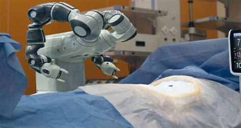 Medical Robots: Types, Benefits, and Machining Processes - WayKen