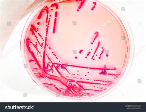 Escherichia Coli Growth On Macconkey Agar Stock Photo