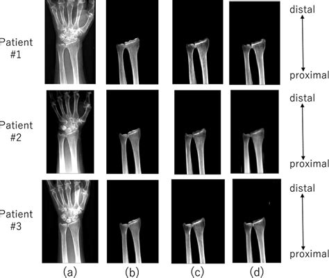 Image translation: (a) actual X-ray image; (b) actual X-ray image ...