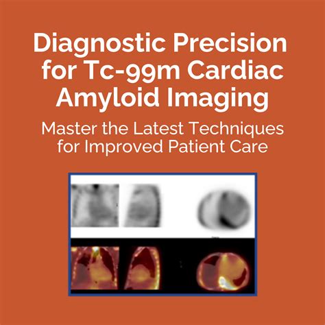 Diagnostic Precision For Tc M Cardiac Amyloid Imaging Master The