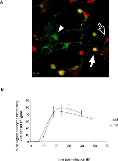 Infection Of Primary Cultures Of Oligodendrocytes From Wild Type Or