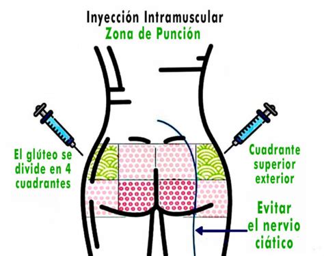 Seguridad En Inyectables Megaclub