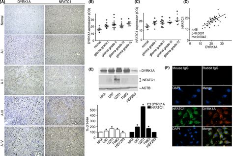 DYRK1A And NFATC1 Protein Expression Were Coordinately Increased In