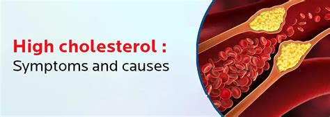 High Cholesterol Your Ultimate Guide To Symptoms Causes Treatment