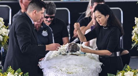 Ele Ficou Assim Vazam Fotos Do Corpo De Pel Em Seu Vel Rio E Deixa