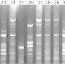 Analysis With Pot2 Rep PCR Showing DNA Fingerprint Profiles Of