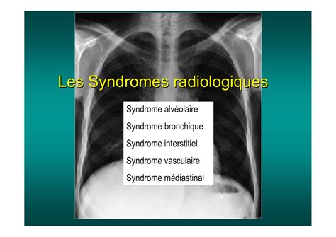 Les Syndromes Radiologiques Soutien Pneumologique International