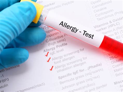 The Truth Behind At-Home Allergy Testing - Colorado Allergy & Asthma ...