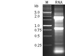 Evrogen Technologies: RNA electrophoresis protocol