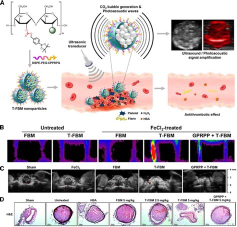 A Thrombinresponsive Theranostic Nanoplatform For Photoacoustic